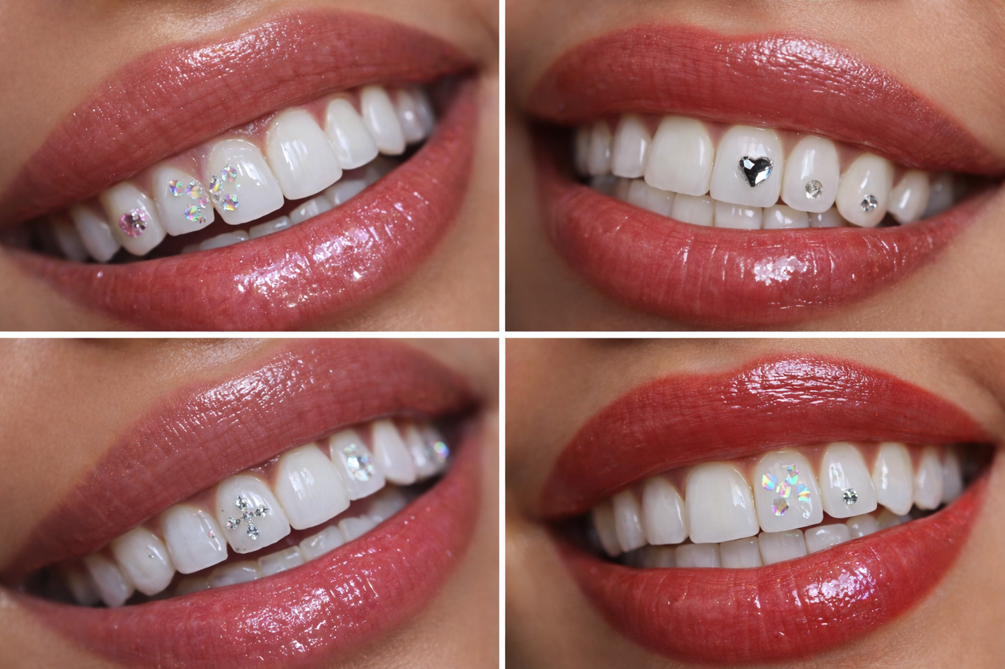 Tooth Gem Set – Strahlendes Lächeln mit Wow-Effekt ✨ -bald erhältlich