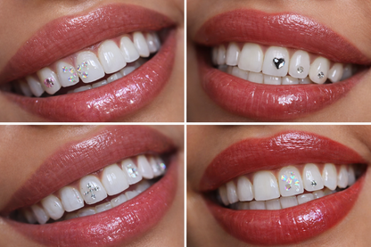 Tooth Gem Set – Strahlendes Lächeln mit Wow-Effekt ✨ -bald erhältlich
